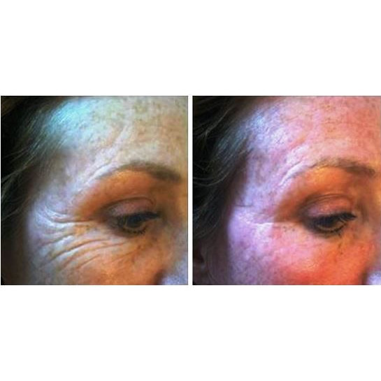 eye-serum-bottle-package-125-web.png